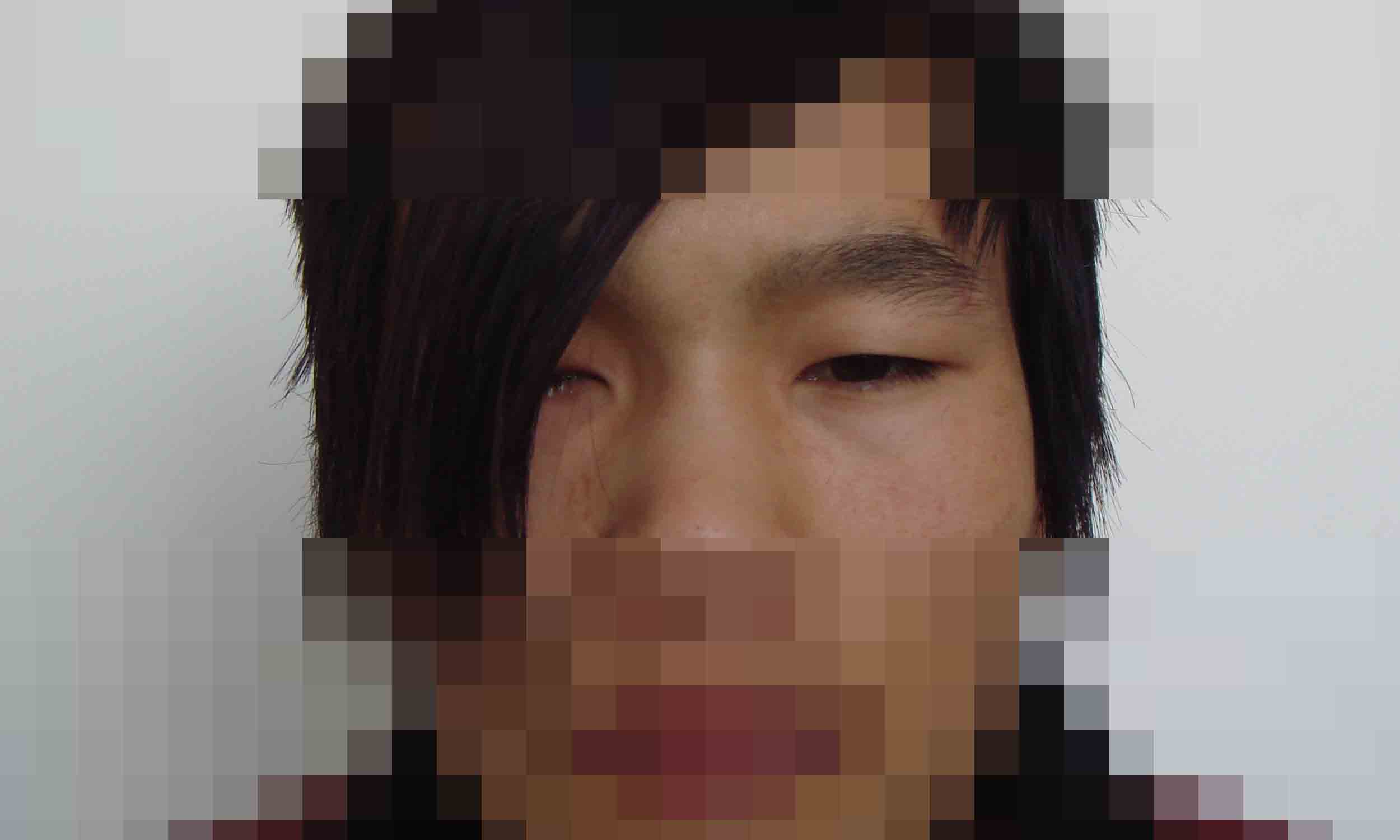 手術前長發遮面